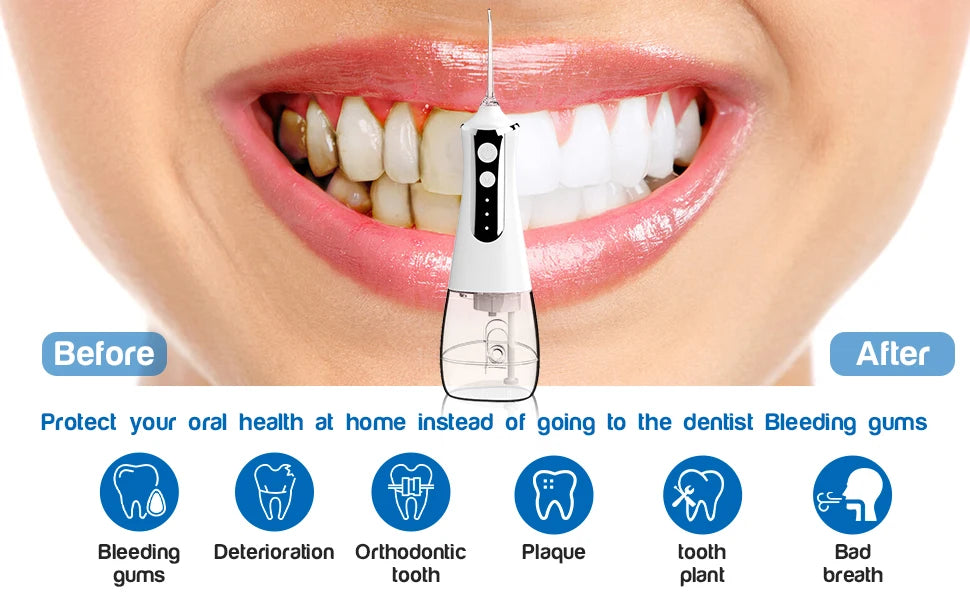 Water Flosser Teeth Picks, Cordless Portable Oral Irrigator, Powerful And Rechargeable Water Flosser For Teeth, Brace Care
